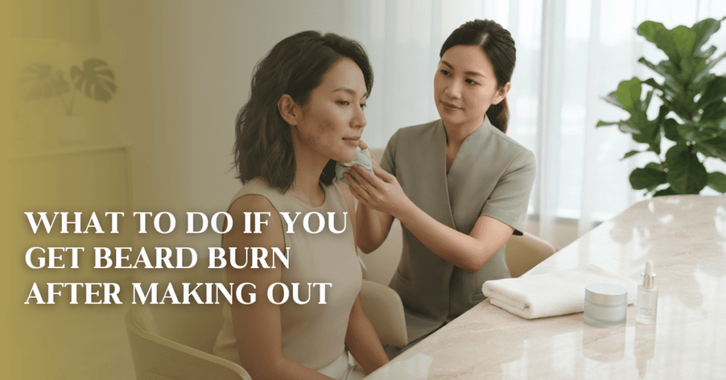 Beard Burn
